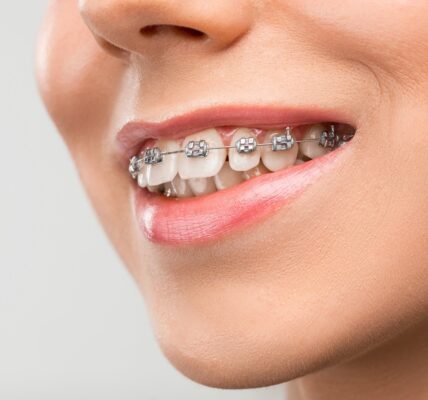Understanding Orthodontic Relapse and Why Teeth Shift After Treatment Ends
