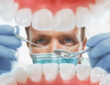 Understanding Interproximal Contact Points and Their Essential Role in Maintaining Dental Stability